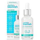 Bye Bye Blemish Rescue Niacinamide Serum 30 ml